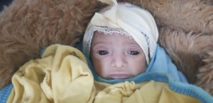 مؤثر جداً طفله في تعز رُفض اجراء عمليه لها بسبب التكاليف وعندما وجدت من يكفلها كان الوقت قد تأخر فماتت