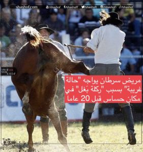 مريض سرطان يواجه “حالة غريبة” بسبب “ركلة بغل” في مكان حساس قبل 20 عاما