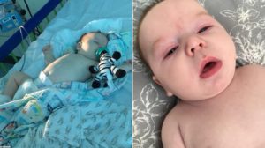 “ديلي ميل” طفل رضيع يبلغ من العمر 11 أسبوعًا فقط يكافح فيروس كورونا