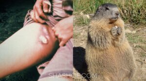 الصين تعلن مستوى الخطر الثالث لتفشي مرض الطاعون الدملي