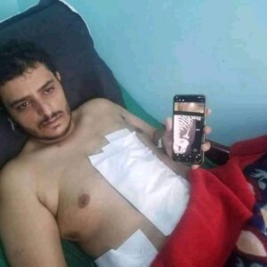 قصة استخراج مقص من بطن مريض في مأرب بعد نسيانه الحقيقة كاملة بالصور !