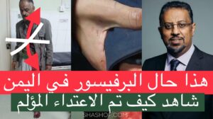 الحقيقة الان.. البرفيسور اليمني عبدالله عمر الحكيمي يروي كيف تم الاعتداء عليه