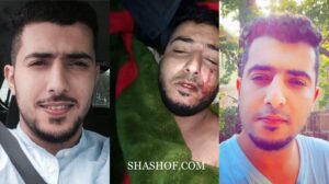 صديق عبدالملك السنباني يروي قصة مقتله بطلقة في الضهر وينشر صور جديدة على صفحته!