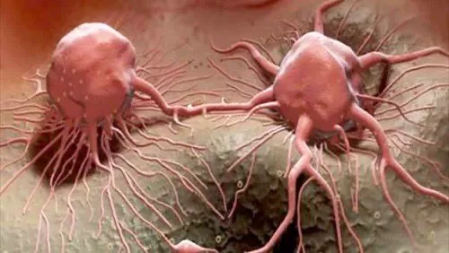 خلايا سرطانية