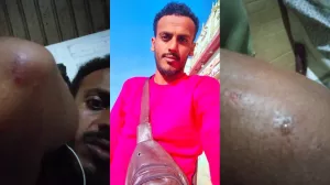 اثناء البث المباشر: هجوم غادر على الناشط اليمني الساخر “أبو عيون” في جنوب اليمن