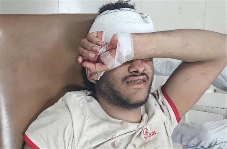 تعز.. إصابة شاب بجروح بالغة برصاص قناص حوثي