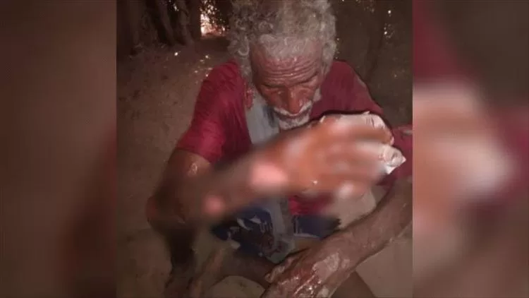 وفاة طفلة وإصابة أفراد من أسرتها جراء حريق التهم مسكنهم في الحديدة