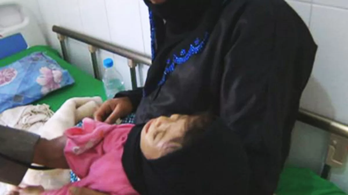 الأمم المتحدة: انعدام الغذاء يهدد نصف سكان مناطق سيطرة حكومة اليمن