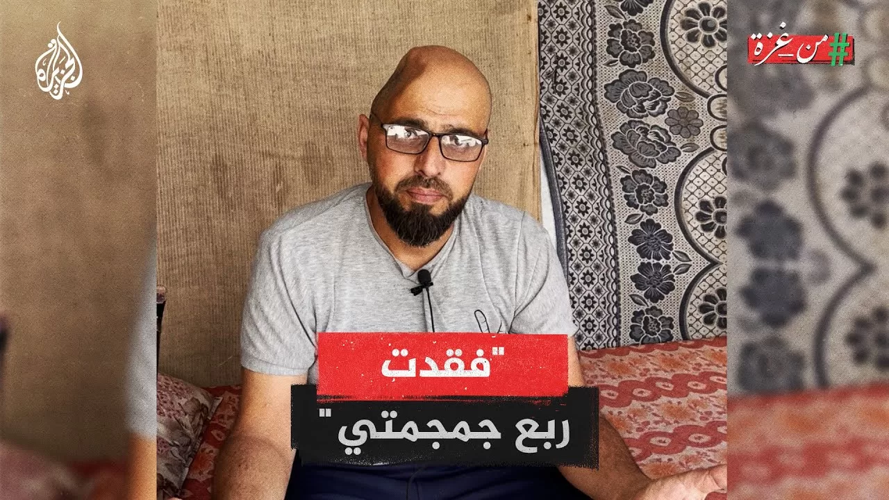 "فقدت ربع جمجمتي".. حازم جودة فلسطيني من غزة  فقد ربع جمجمته إثر قصف إسرائيلي