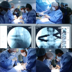 اخبار عدن – إجراء جراحة فريدة من نوعها في العاصمة عدن