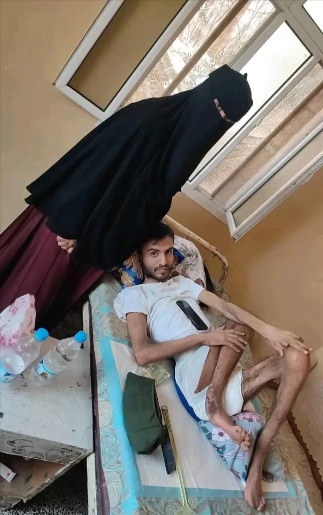 تعز: مناشدة لإنقاذ مقاتل في الجيش طريح الفراش منذ ثلاث سنوات