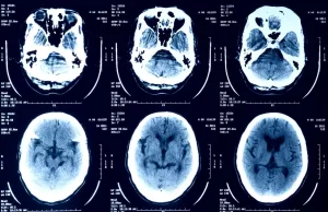 إبسورس تُخطِر ملايين الأشخاص بأن بياناتهم الصحية قد سُرِقت