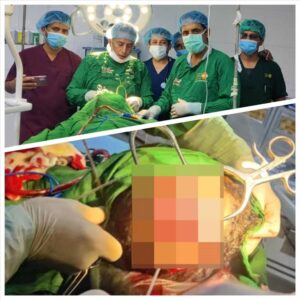 اخبار المناطق – شاب يُصاب في رأسه جراء سقوط حجر أثناء حفر بئر في بيحان بشبوة.